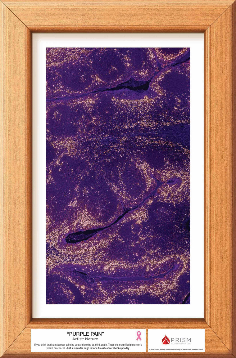 廣告公司為乳腺癌體檢檢測公益宣傳月設(shè)計的抽象藝術(shù)風(fēng)創(chuàng)意海報賞析-紫色的痛苦 廣告公司為乳腺癌體檢檢測公益宣傳月設(shè)計的抽象藝術(shù)風(fēng)創(chuàng)意海報賞析-紫色的痛苦